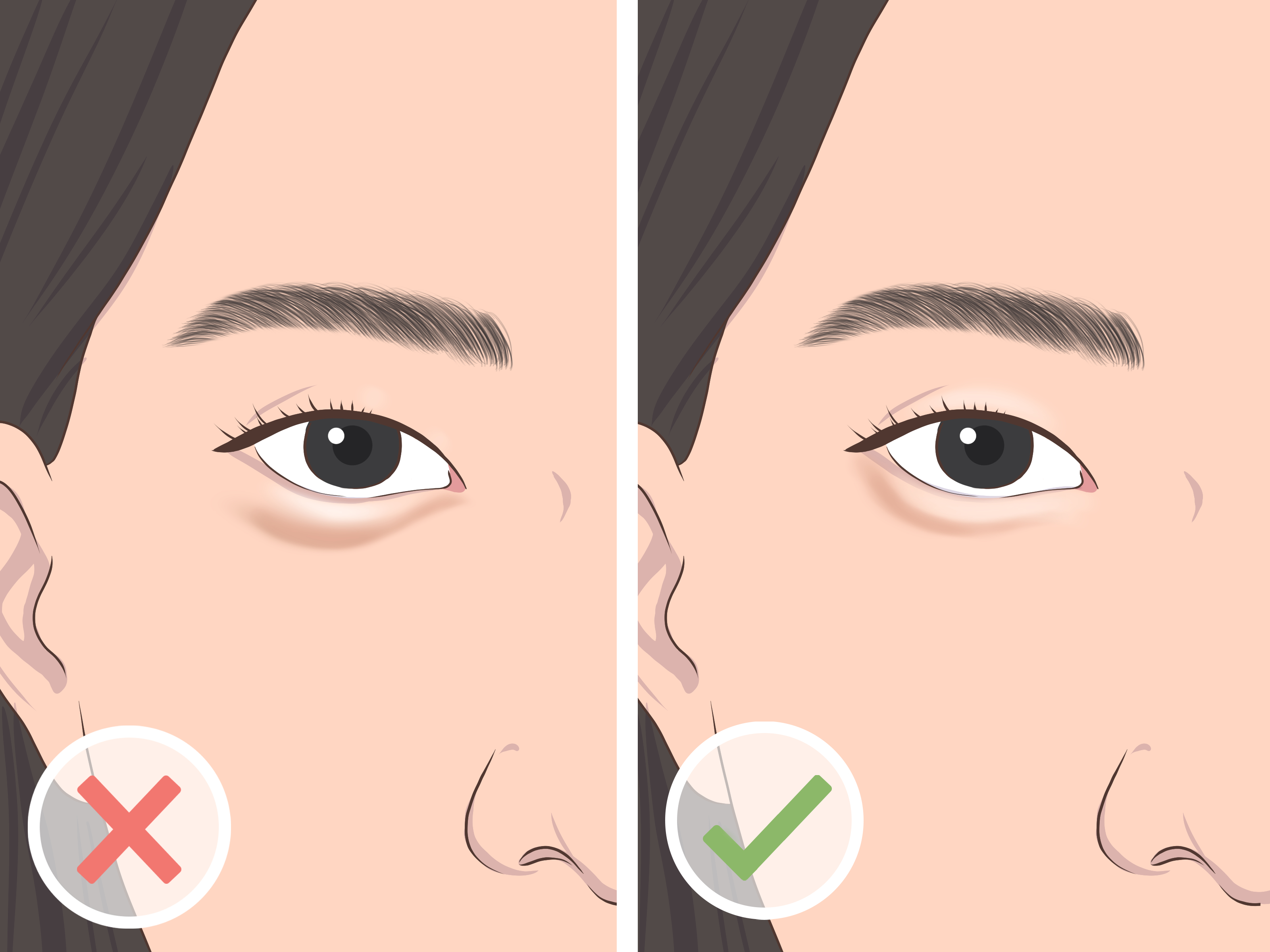 Aegyo Sal vs. Eye Bags: The Korean Beauty Difference Explained